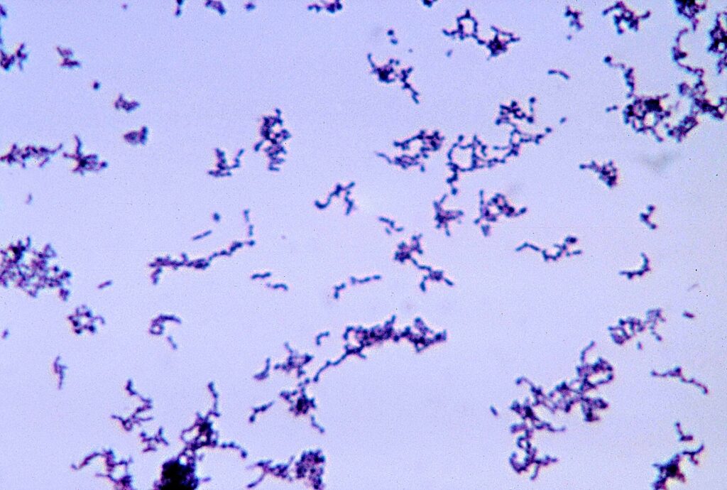 propionibacterium acnes